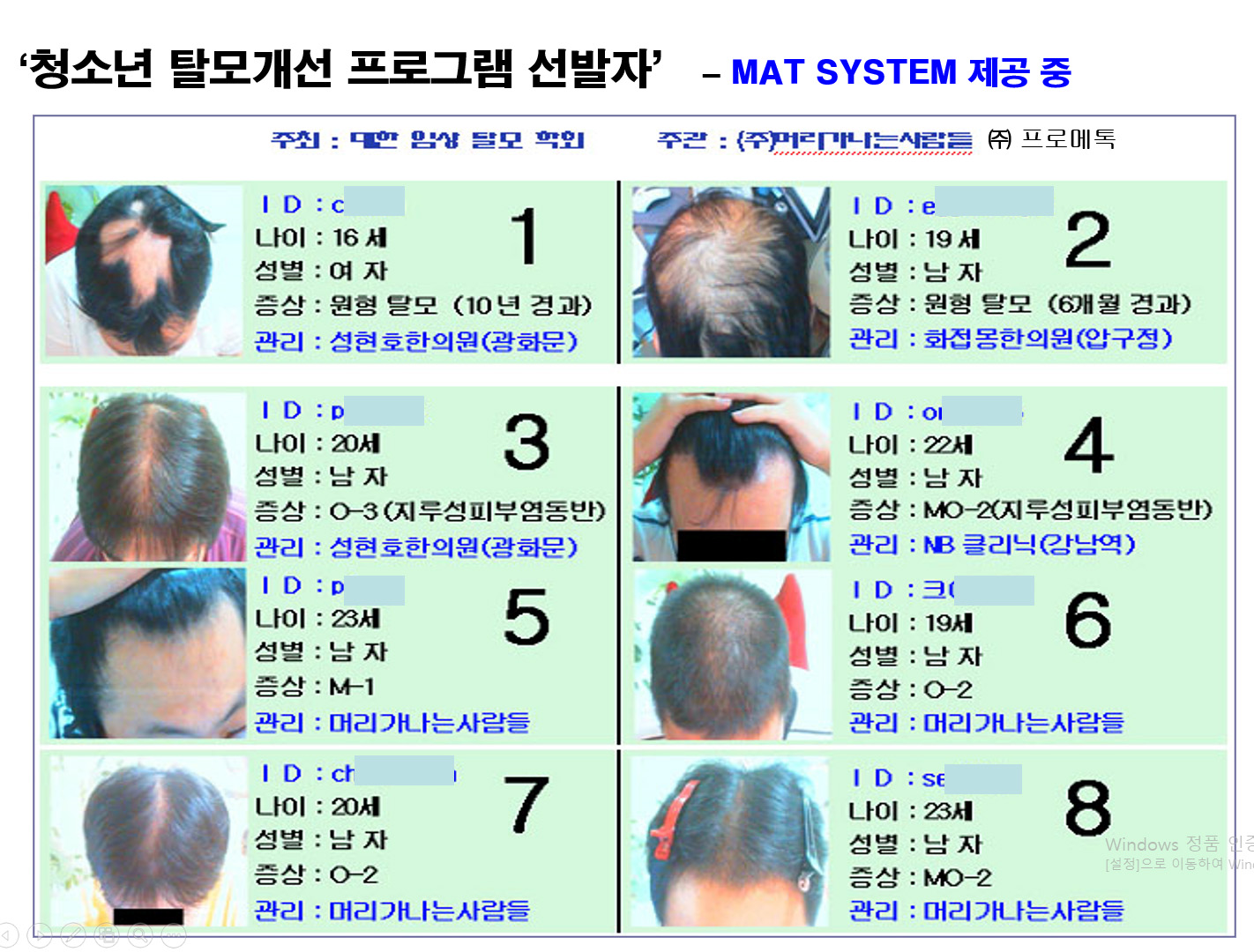 청소년 탈모개선 프로그램 선발자